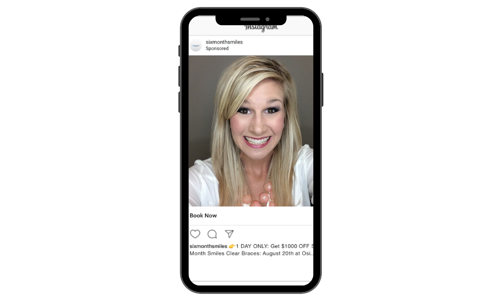 6MS Day IG