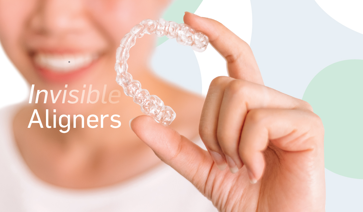 6MS_Aligners1