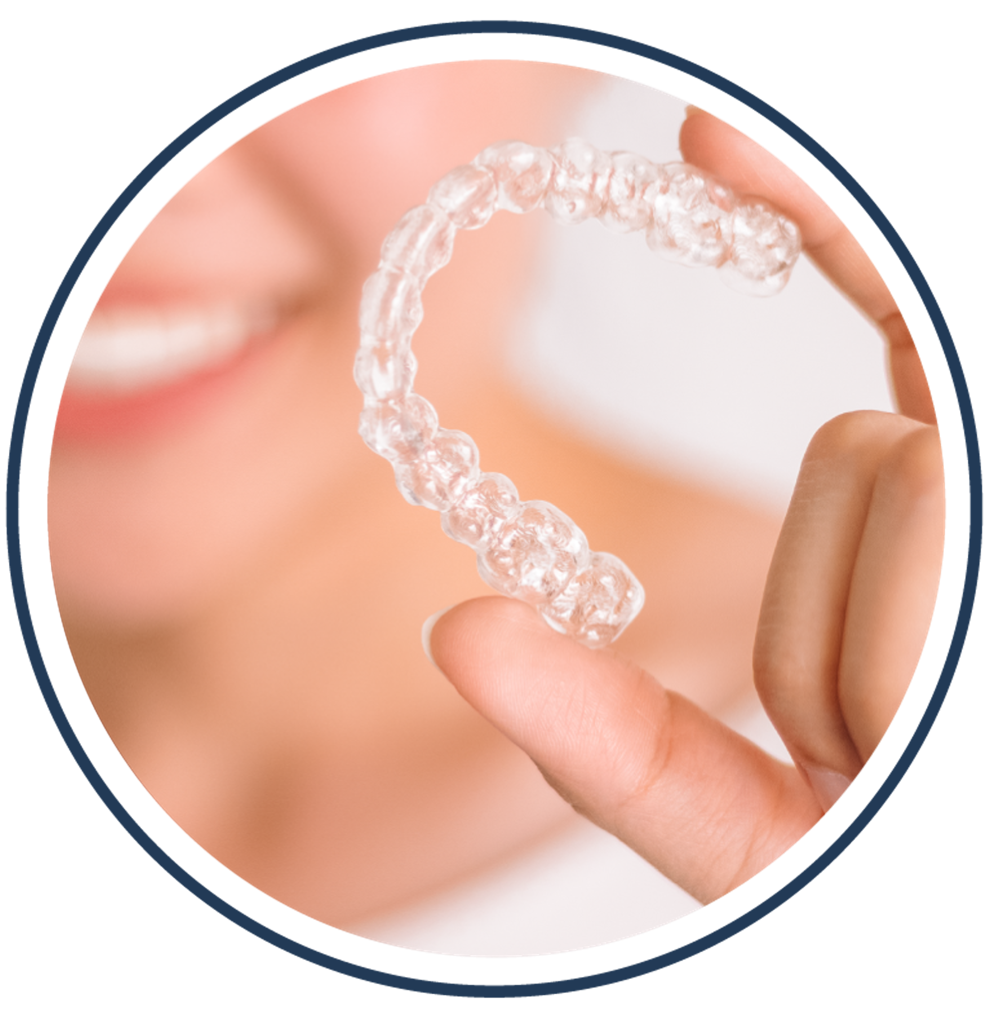 Aligners_circle1_editted