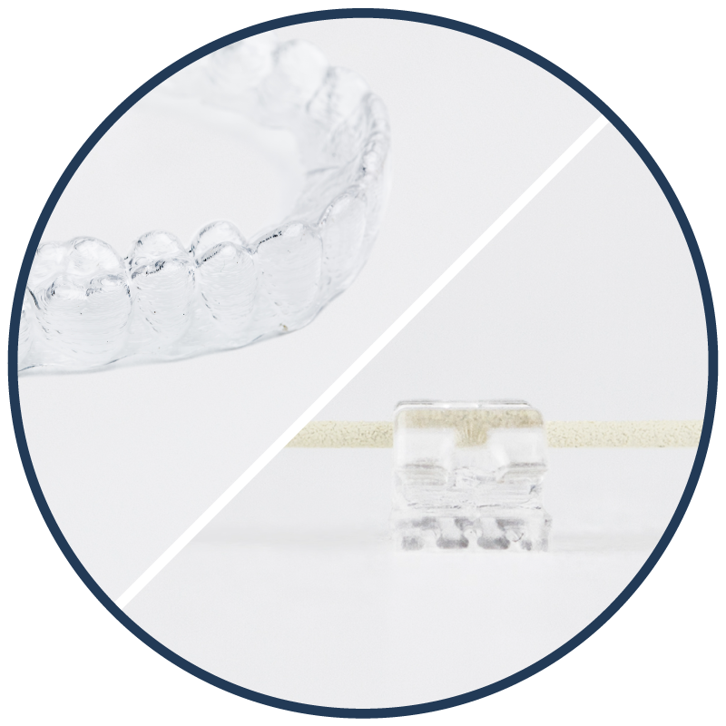 AlignersBraces1