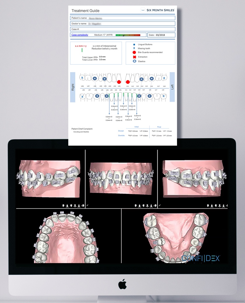 CONFIDEX Treatment Planning