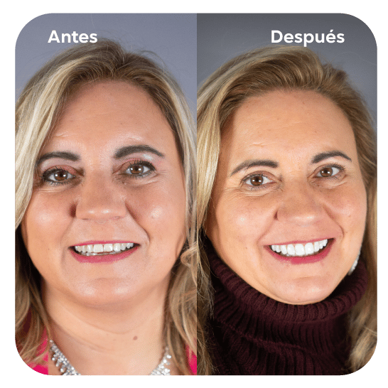 2daVisita 2daVisita