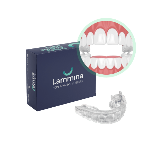 Lammina box Lammina box