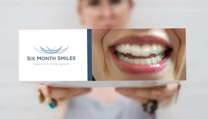 SixMonthSmiles-2-1 SixMonthSmiles-2-1