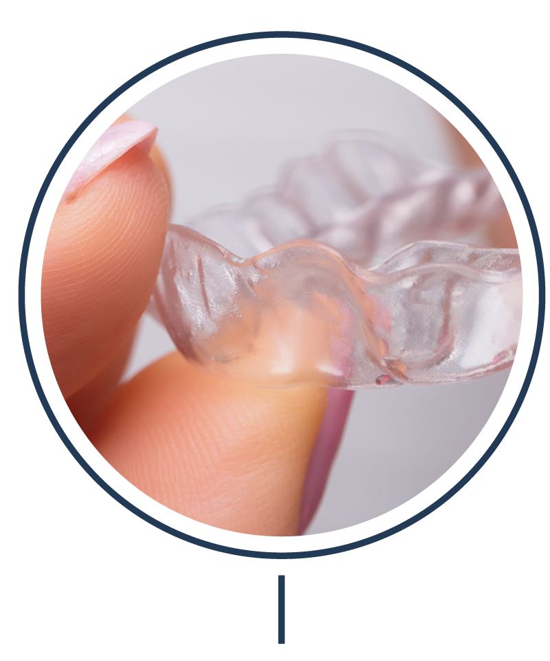 best invisible aligners best invisible aligners