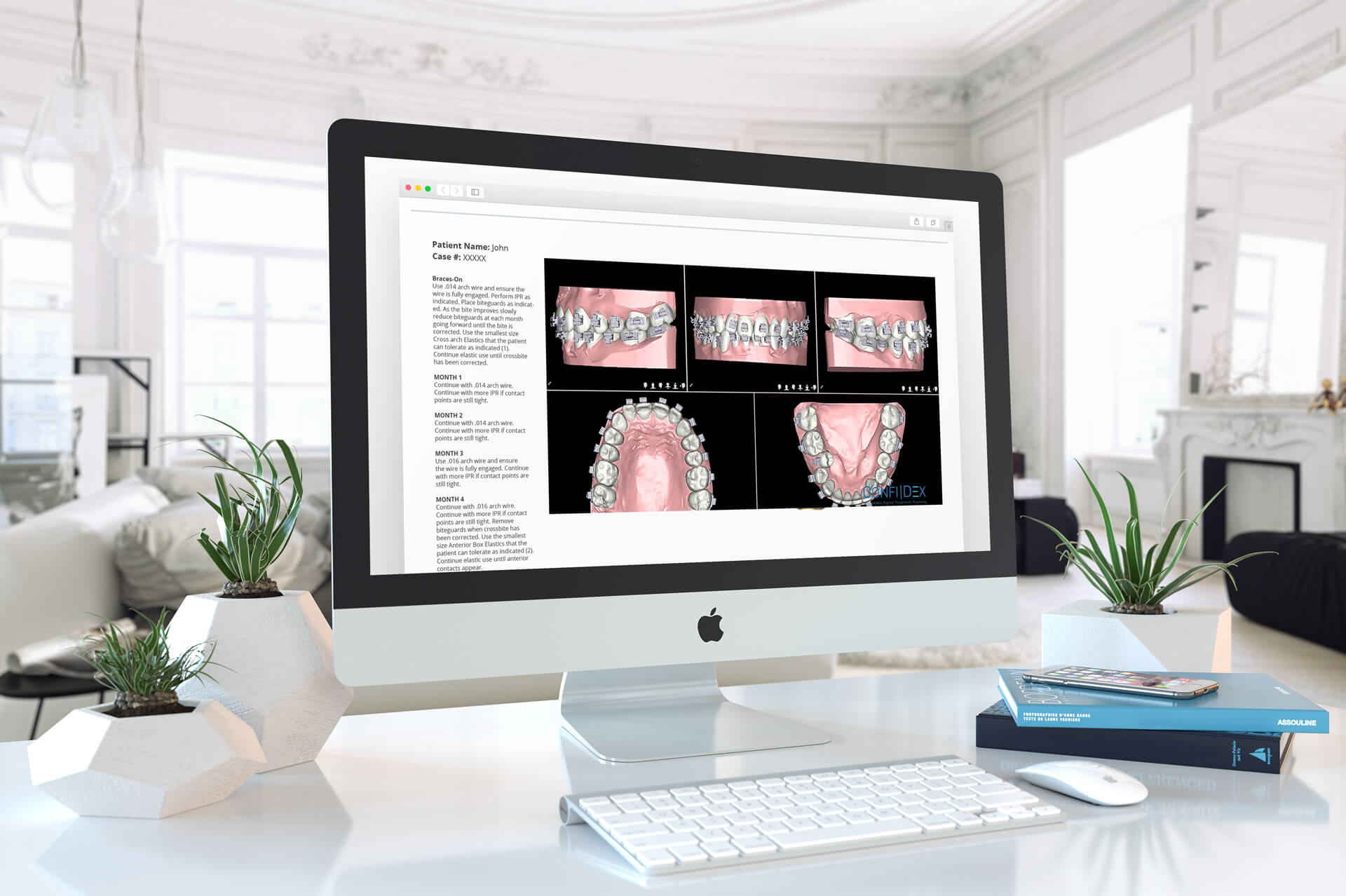Braces_Treatment_Guide