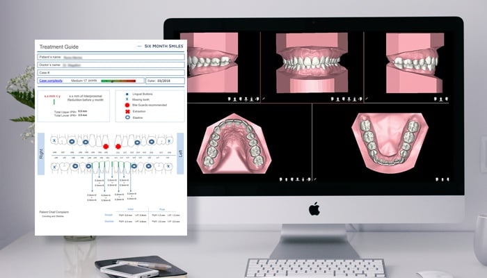 CONFIDEX Treatment Planning